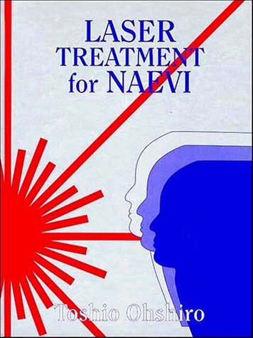 Laser Treatment for Naevi Medicine