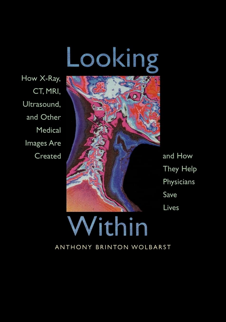 Looking Within: How X-Ray, CT, MRI, Ultrasound, and Other Medical Images Are Created, and How They Help Physicians Save Lives book