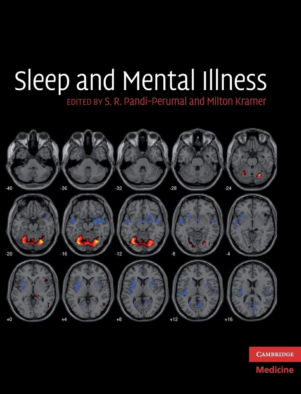 Sleep and Mental Illness (Cambridge Medicine (Hardcover)) Medicine