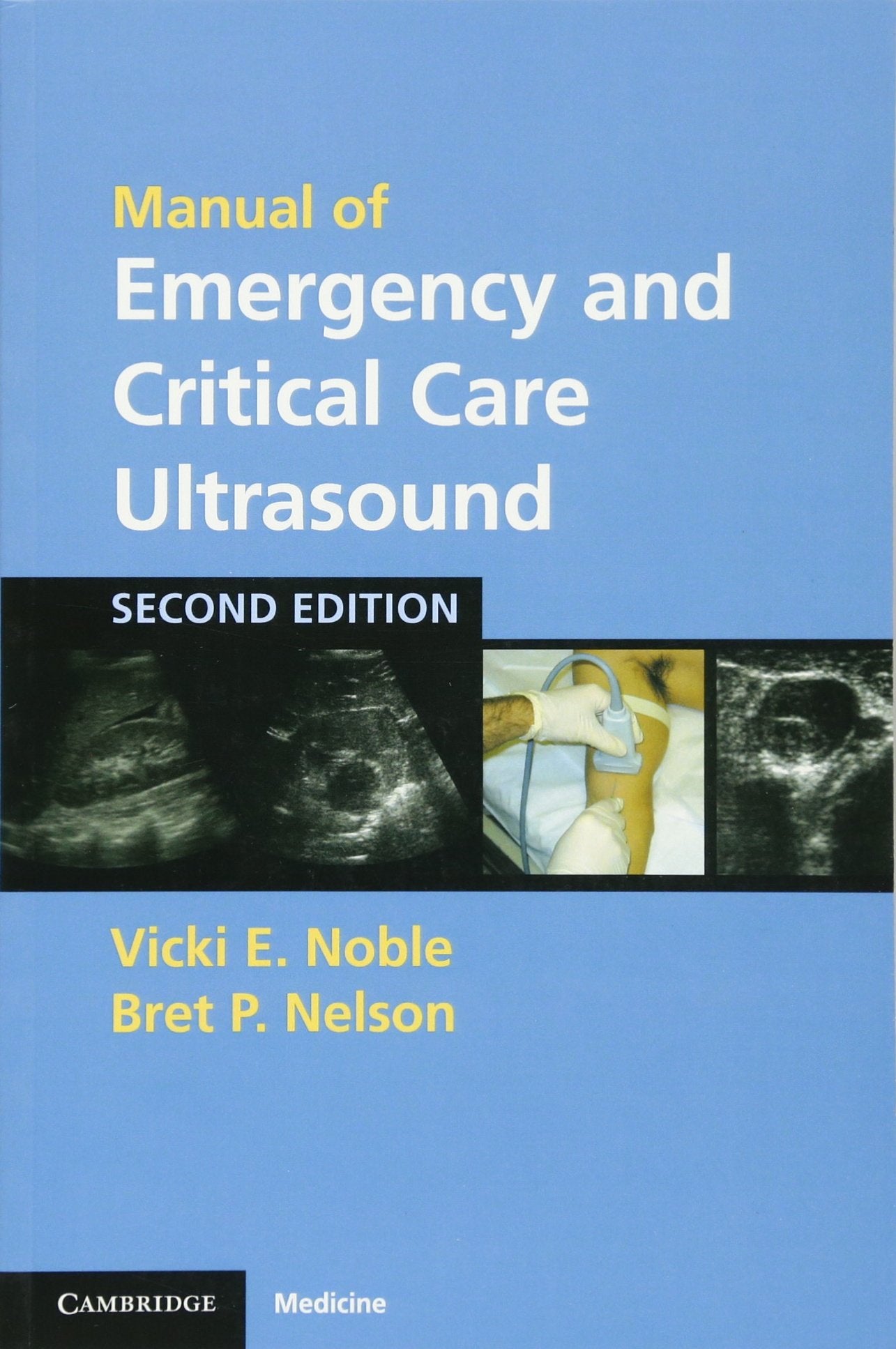 Manual of Emergency and Critical Care Ultrasound Medicine
