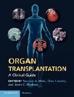 Organ Transplantation: A Clinical Guide Medicine