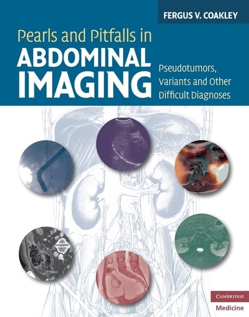Pearls and Pitfalls in Abdominal Imaging: Pseudotumors, Variants and Other Difficult Diagnoses (Cambridge Medicine (Hardcover)) Medicine