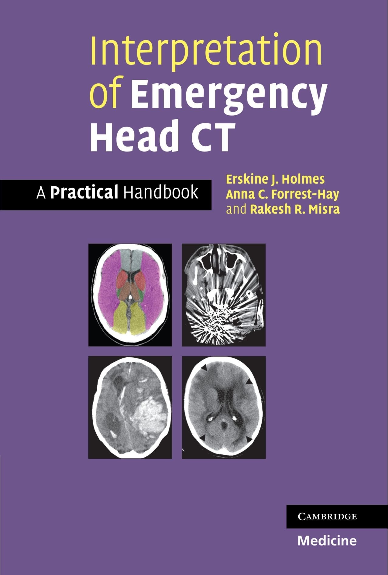Interpretation of Emergency Head CT: A Practical Handbook Medicine