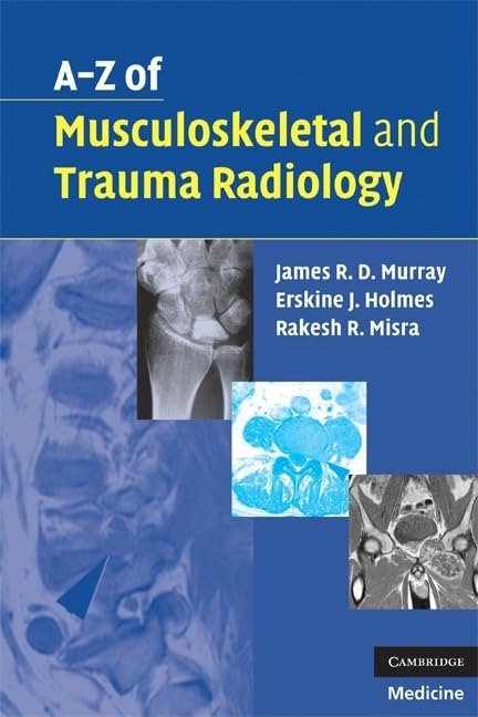 A-Z of Musculoskeletal and Trauma Radiology Medicine