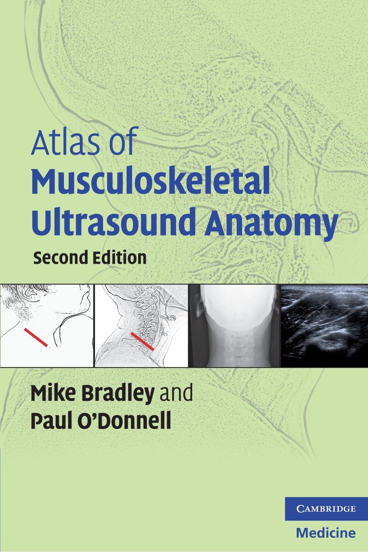 Atlas of Musculoskeletal Ultrasound Anatomy Medicine