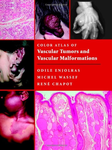 Color Atlas of Vascular Tumors and Vascular Malformations book