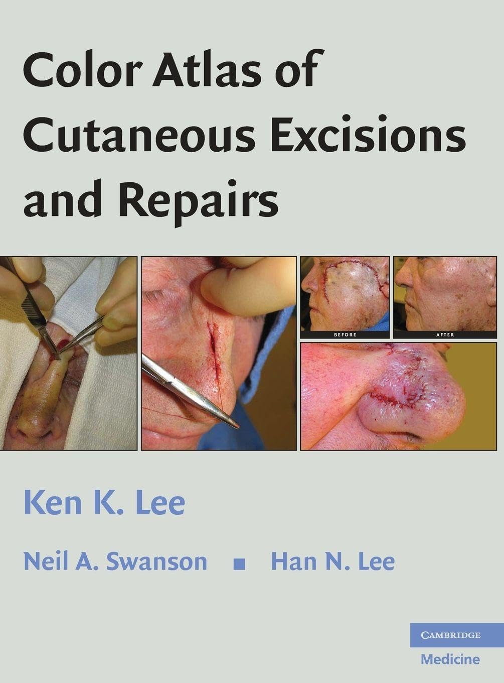 Color Atlas of Cutaneous Excisions and Repairs Medicine