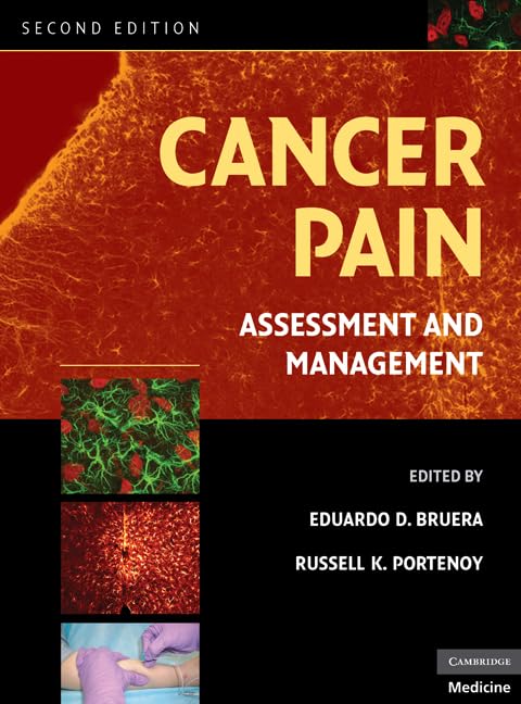 Cancer Pain: Assessment and Management Medicine