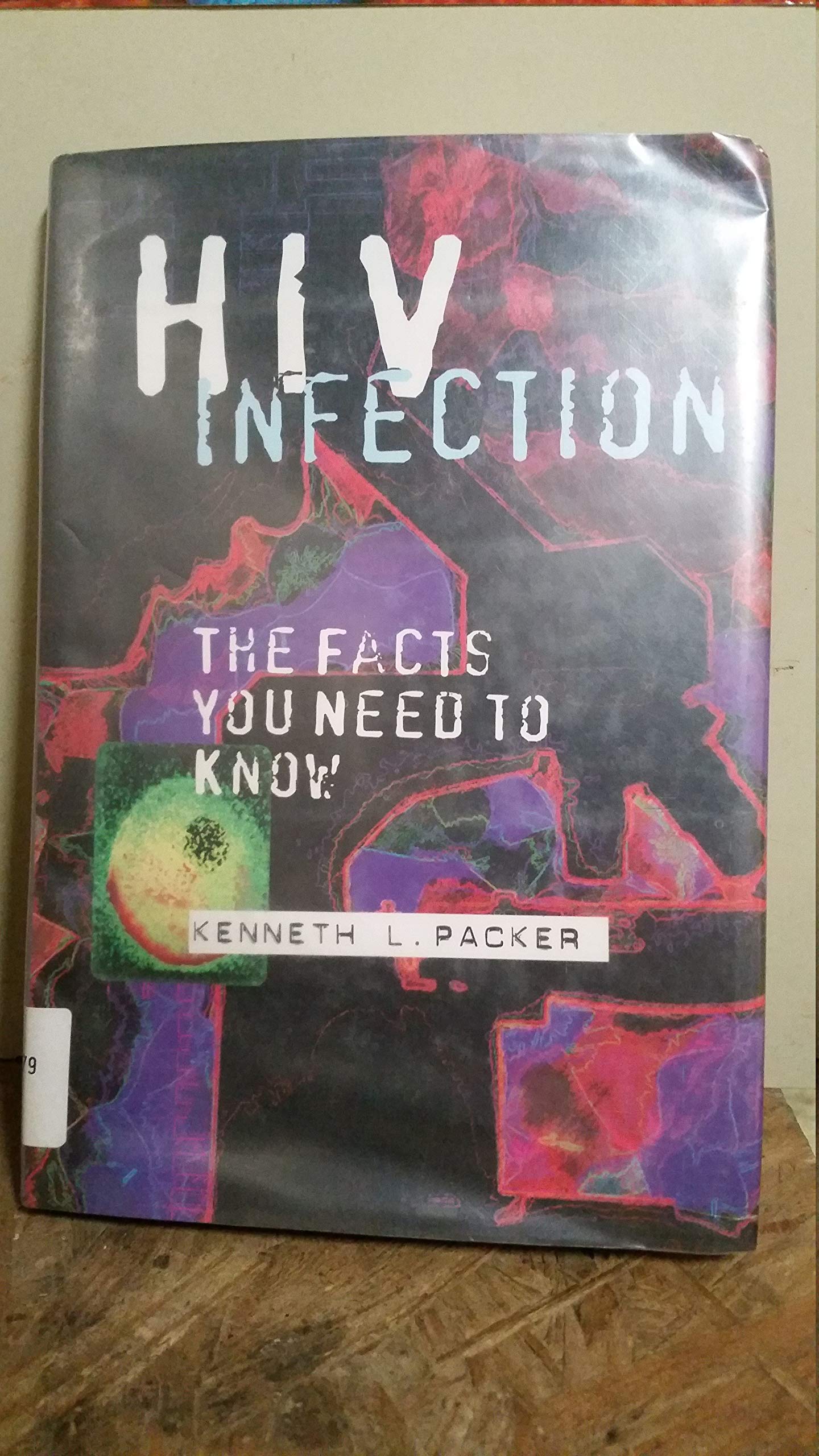HIV Infection: The Facts You Need to Know (Venture Book) Books