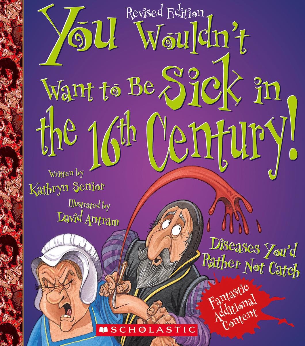 You Wouldn't Want to Be Sick in the 16th Century! Non-fiction