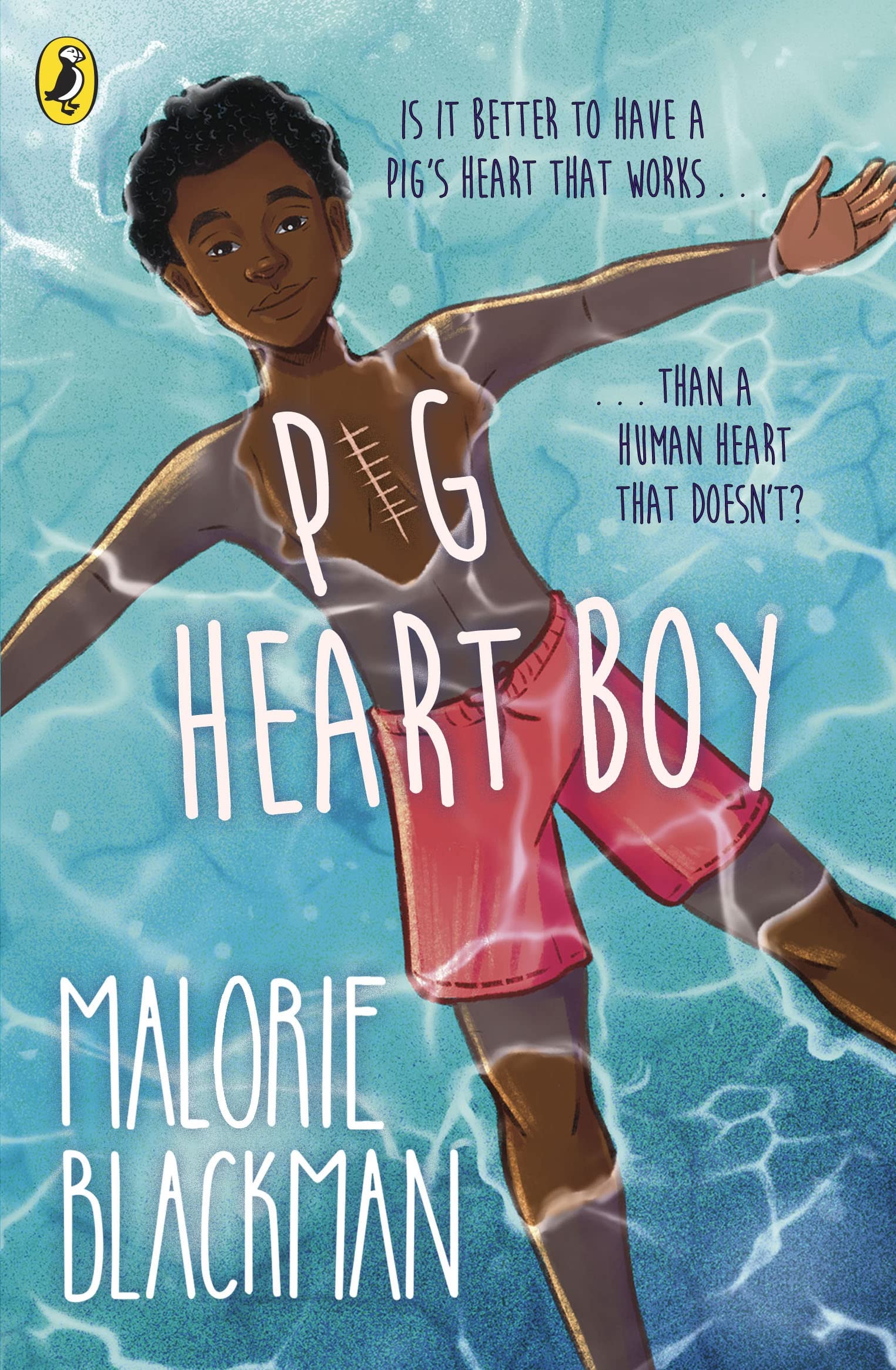 Pig-Heart Boy Non-fiction