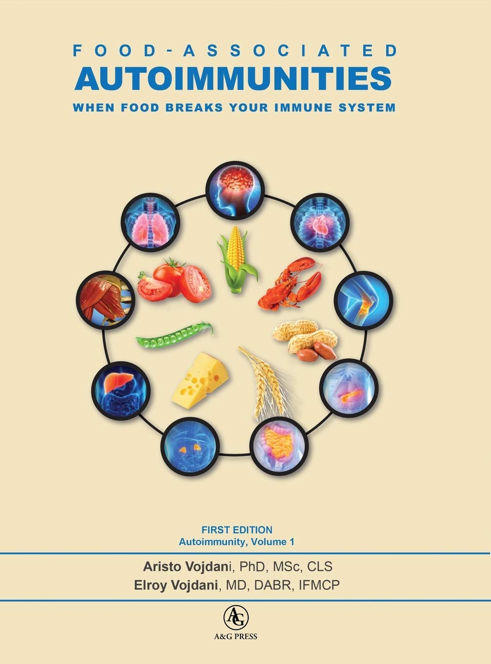 Food-Associated Autoimmunities: When Food Breaks Your Immune System (Autoimmunity, Band 1) Medicine