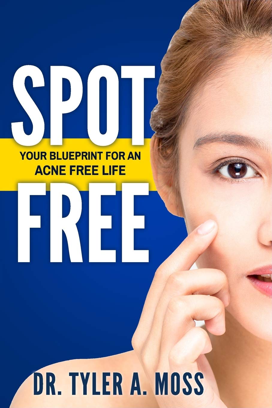Spot Free: Your Blueprint for an Acne Free Life Leisure, Home & Garden