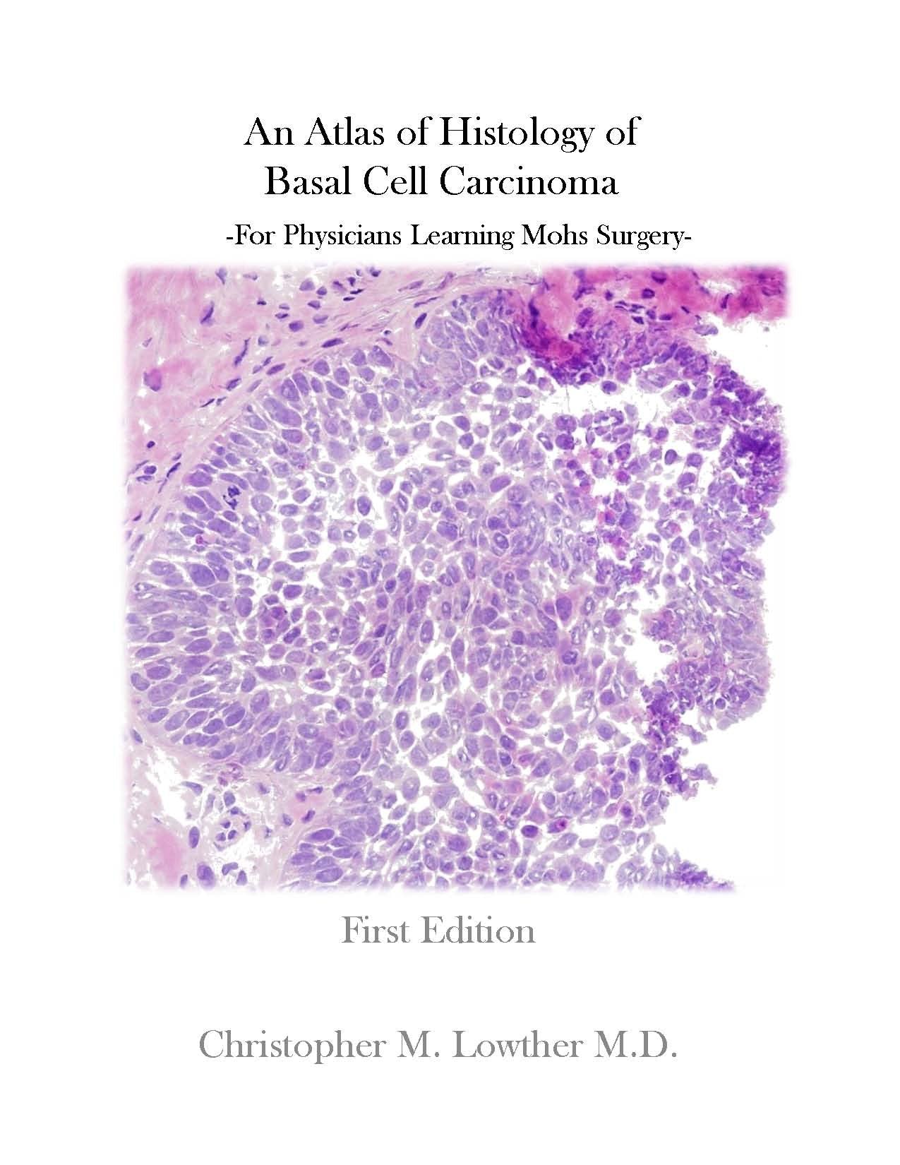 An Atlas of Histology of Basal Cell Carcinoma (For Physicians Learning Mohs Surgery) Books