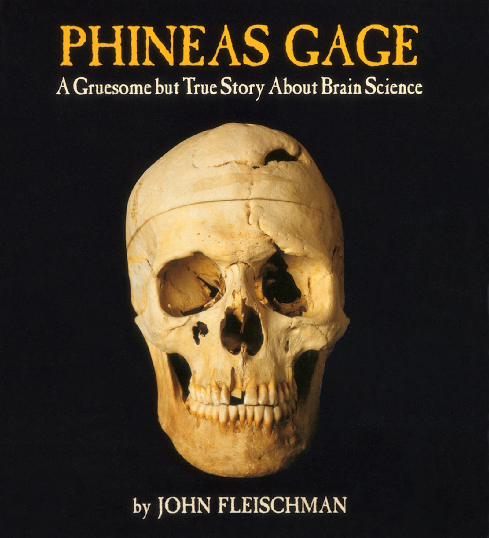 Phineas Gage: A Gruesome but True Story About Brain Science German history