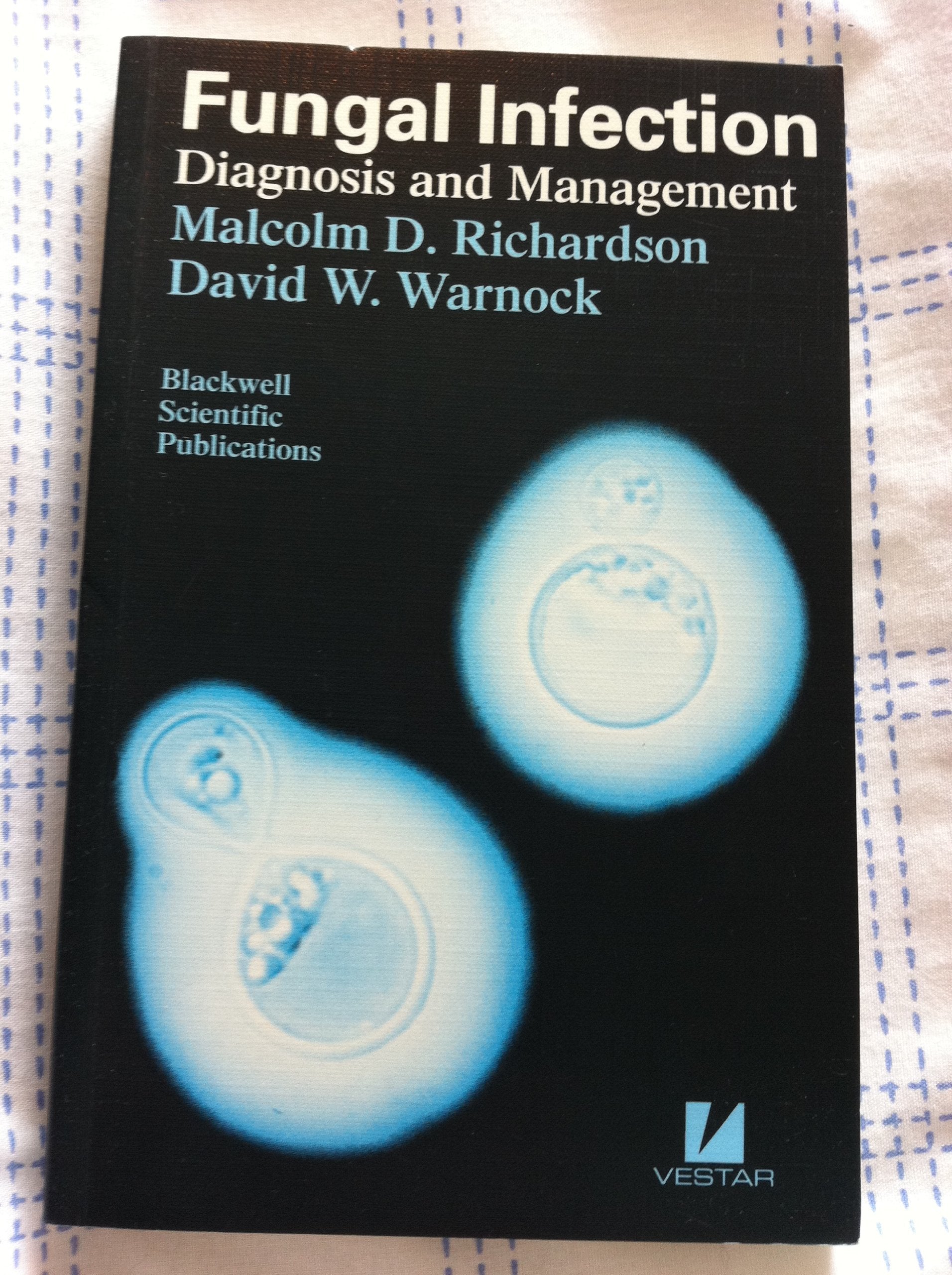 Fungal Infection: Diagnosis and Management book
