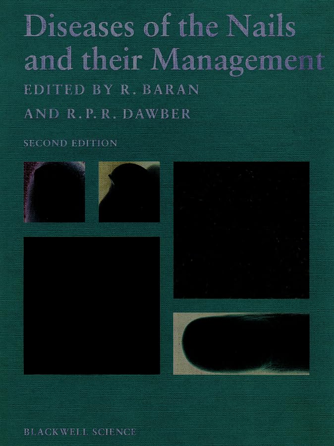 Diseases of the Nails and Their Management Medicine