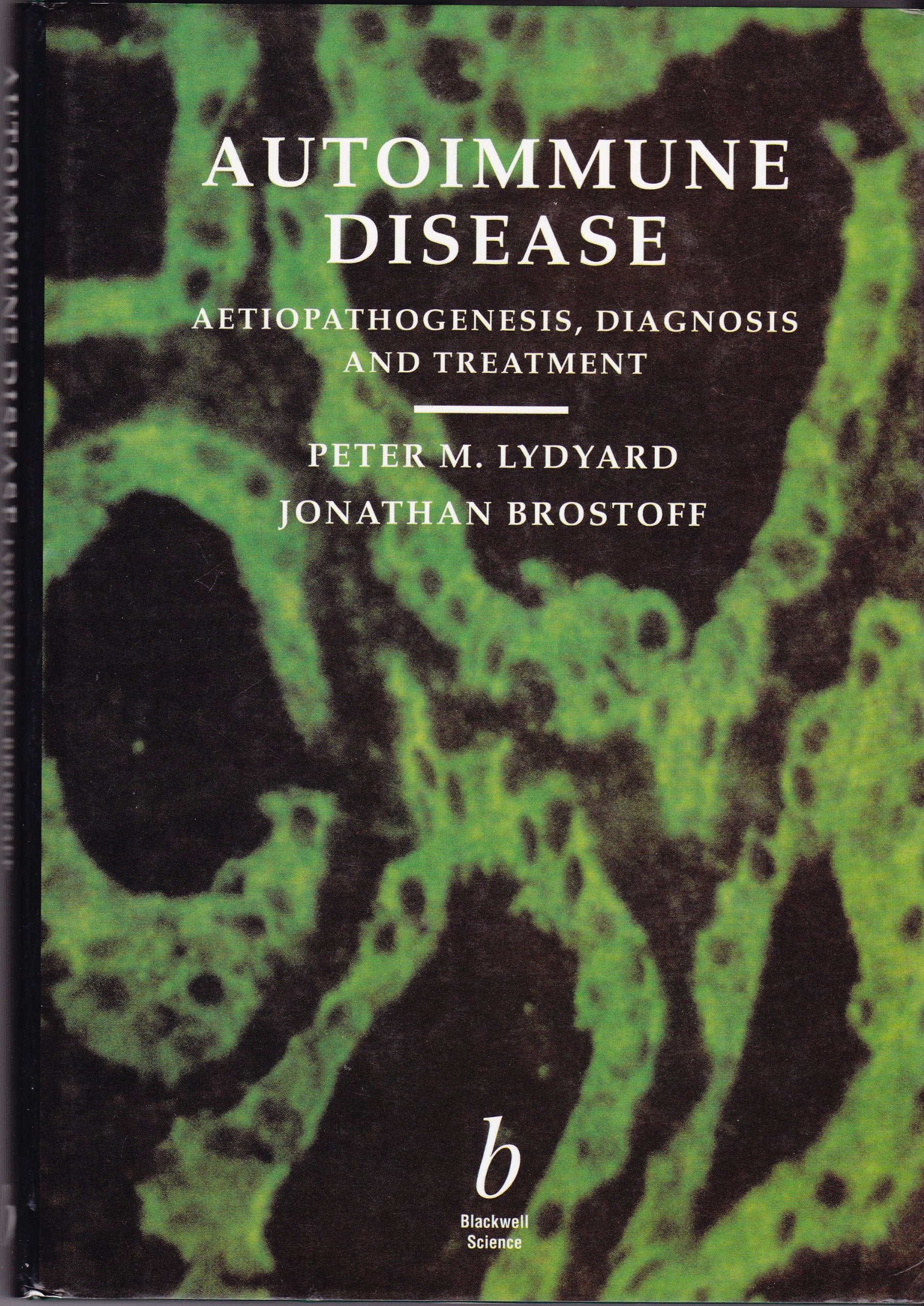 Autoimmune Disease: Aetiopathogenesis, Diagnosis and Treatment : Essays in Honour of the Retirement of Professor Ivan Roitt Frs Medicine