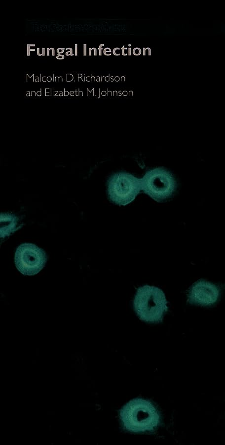 Pocket Guide to Fungal Infection Medicine