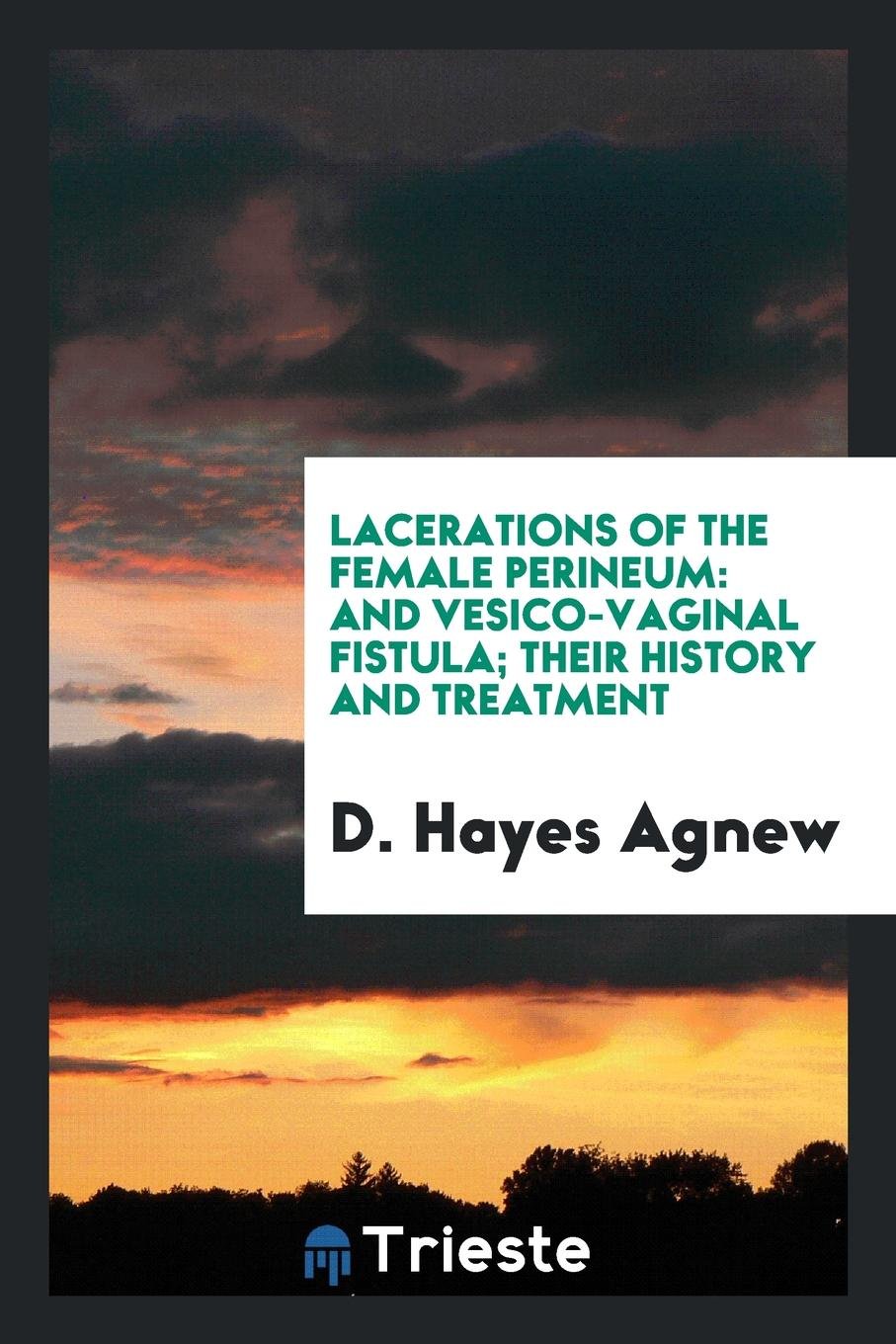 Lacerations of the Female Perineum: And Vesico-Vaginal Fistula Books