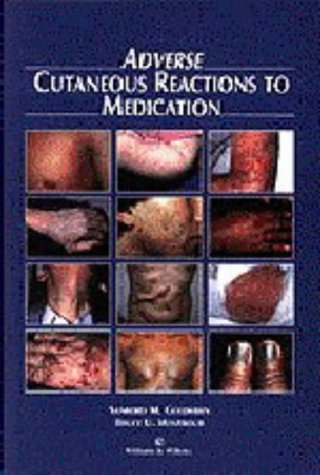 Adverse Cutaneous Reactions to Medication Medicine