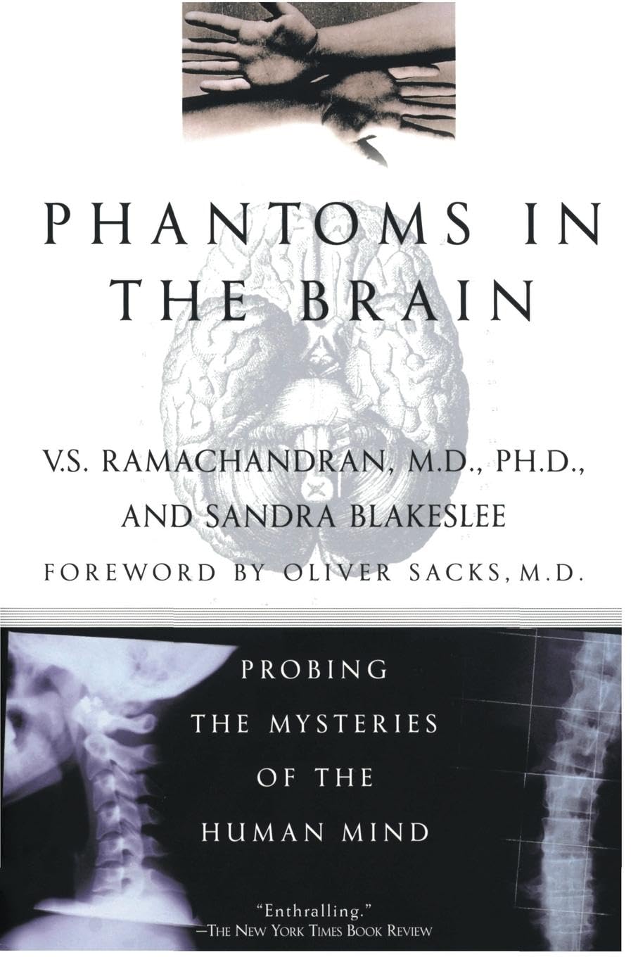 Product Image: Phantoms in the Brain