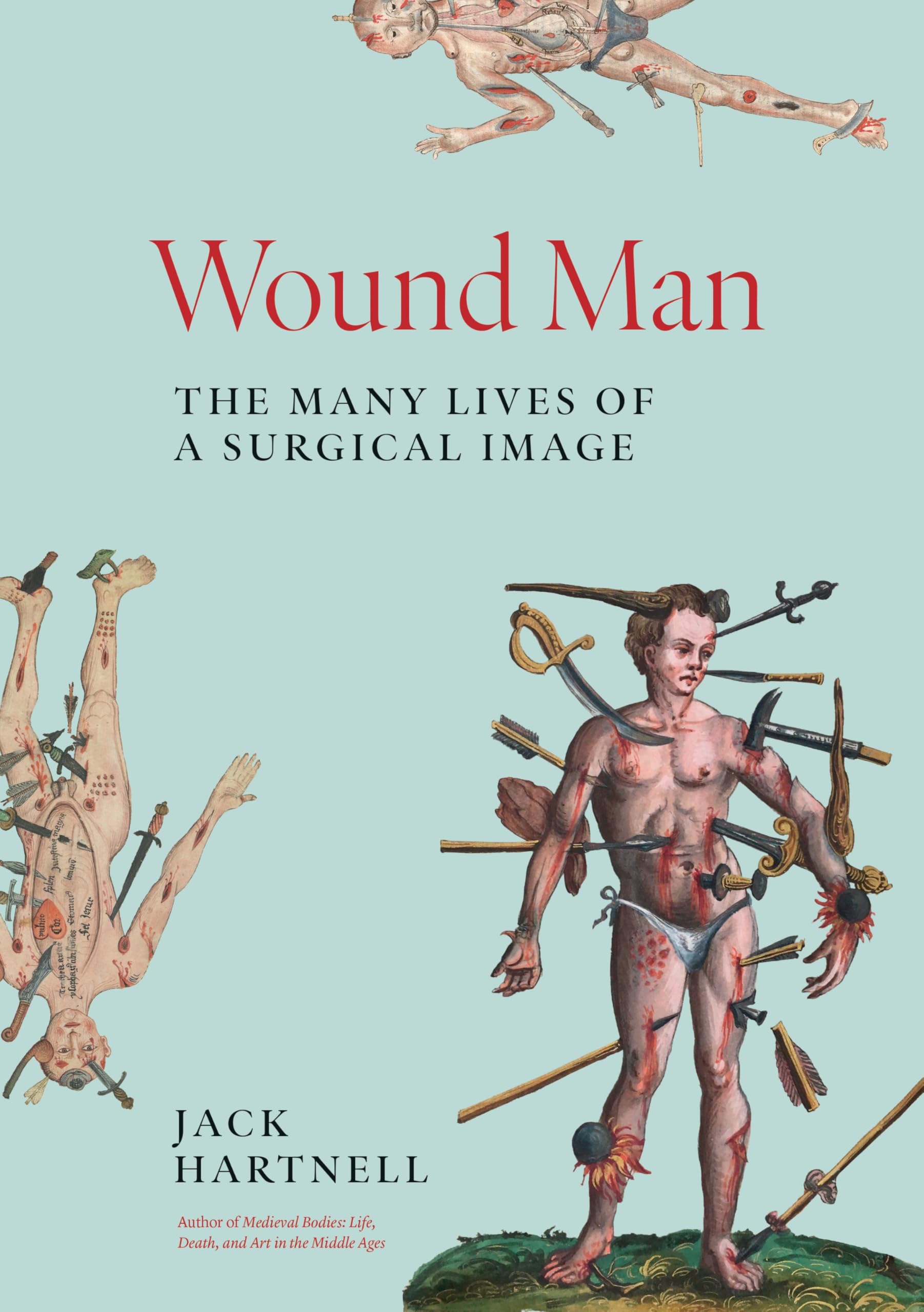Wound Man: The Many Lives of a Surgical Image Medicine
