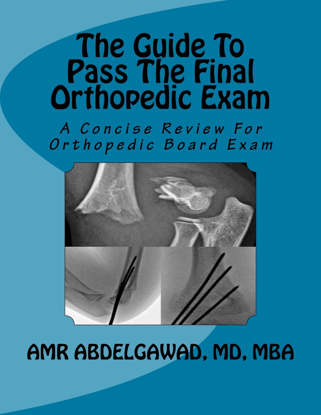 The Guide To Pass The Final Orthopedic Exam: A Concise Review For Orthopedic Board Exam Medicine