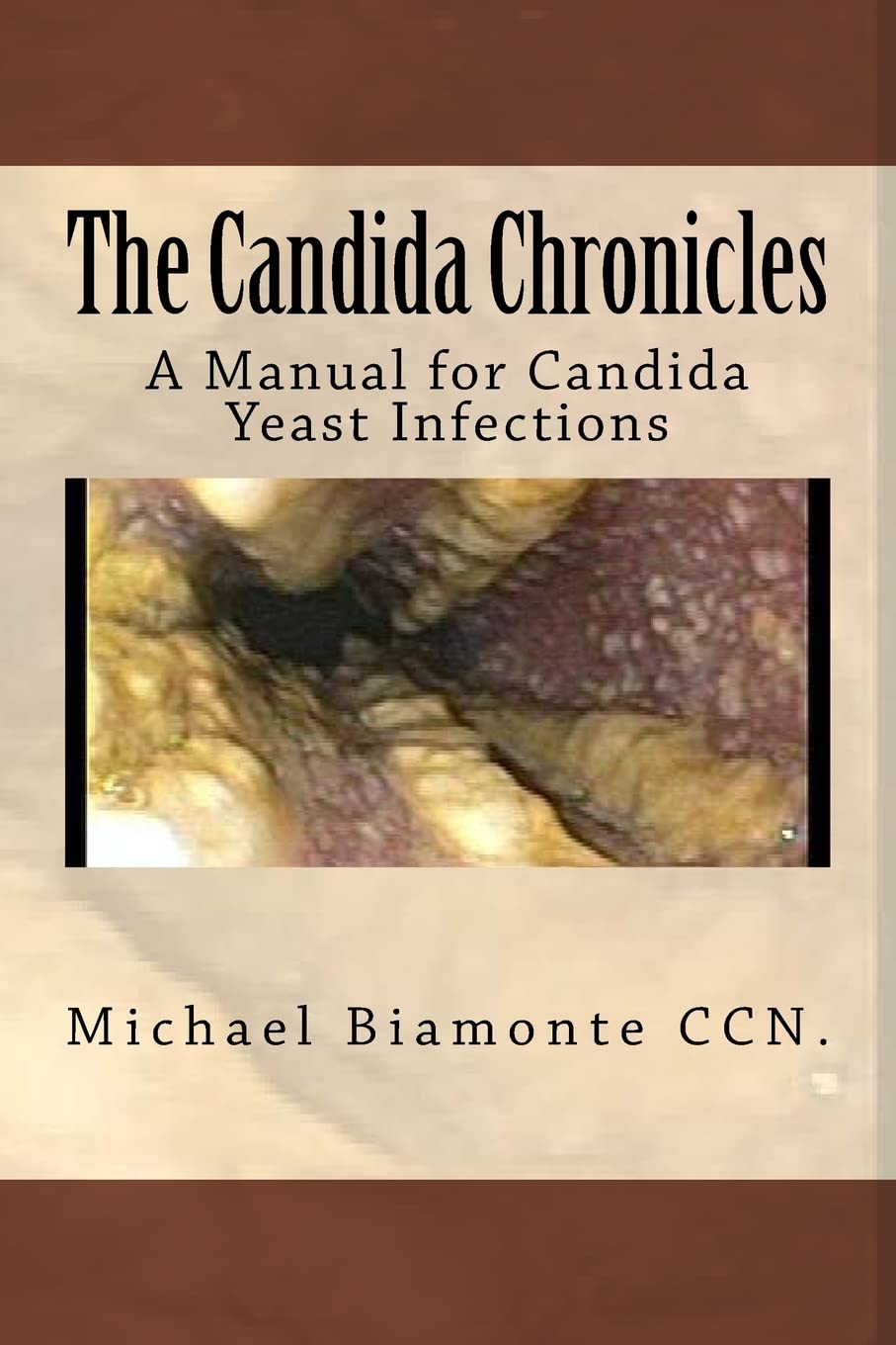 The Candida Chronicles: A Manual for Candida Yeast infections: A Mannual for Candida/Yeast Infections Health, Nutrition & Fitness