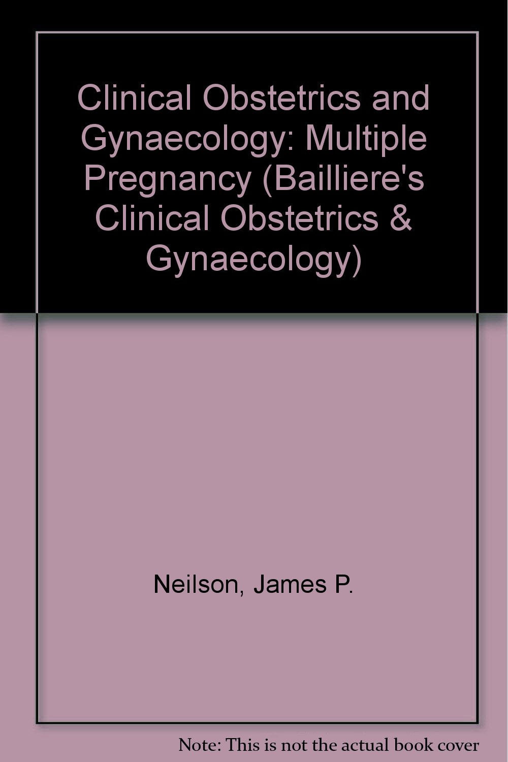 Clinical Obstetrics and Gynaecology: Multiple Pregnancy (Bailliere's Clinical Obstetrics & Gynaecology S.) Medicine
