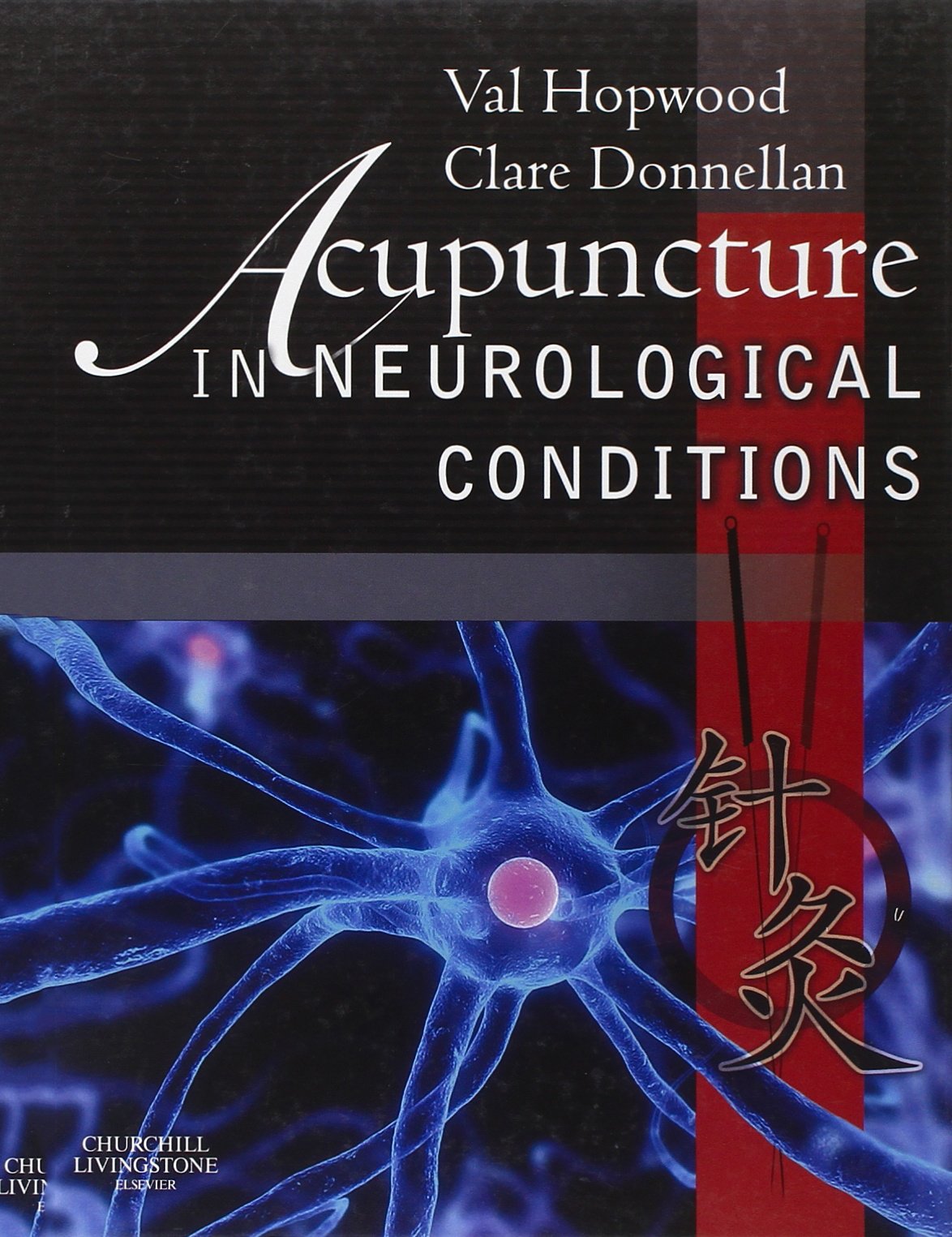 Acupuncture in Neurological Conditions Medicine