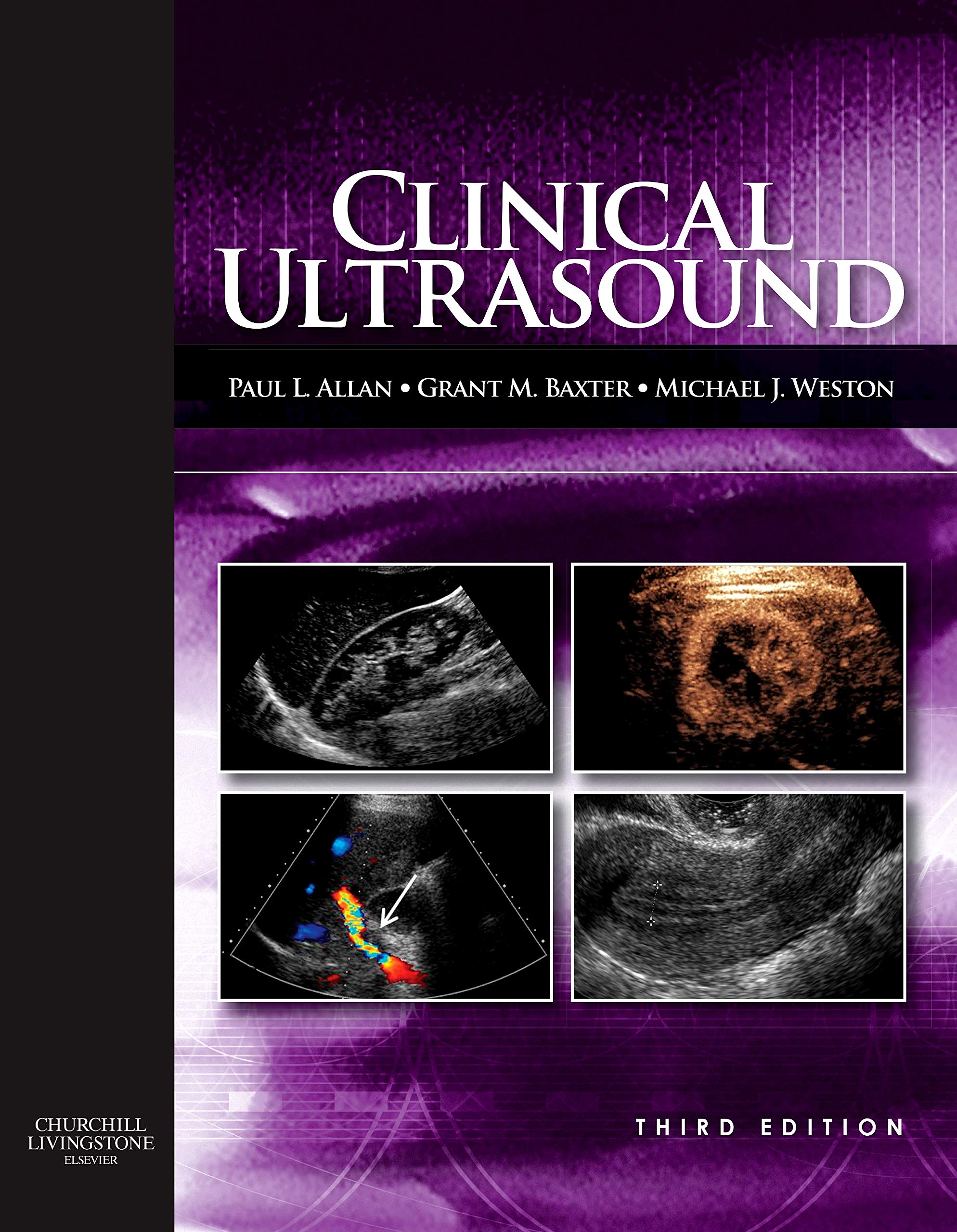 Clinical Ultrasound, 2-Volume Set: Expert Consult: Online and Print Medicine