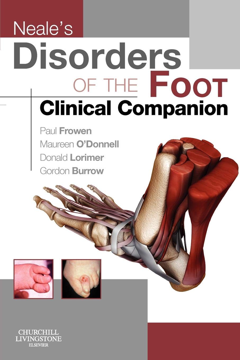 Neale's Disorders of the Foot: Clinical Companion book