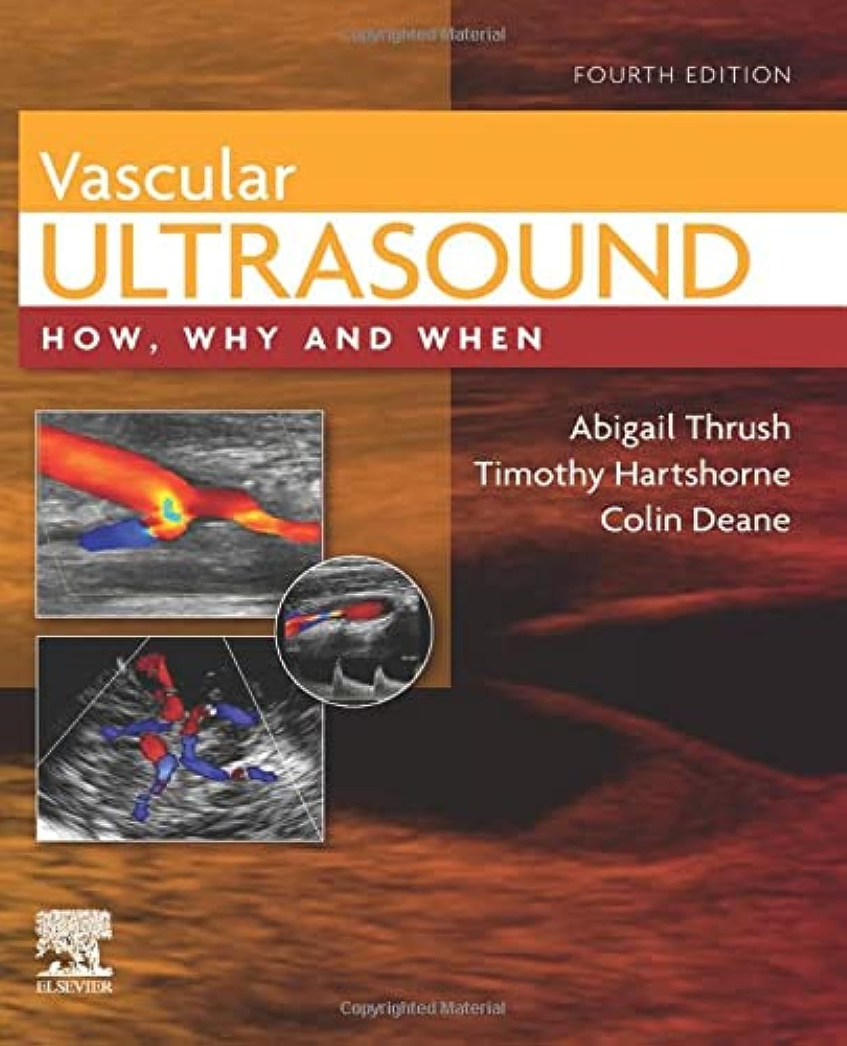 Vascular Ultrasound: How, Why and When Medicine
