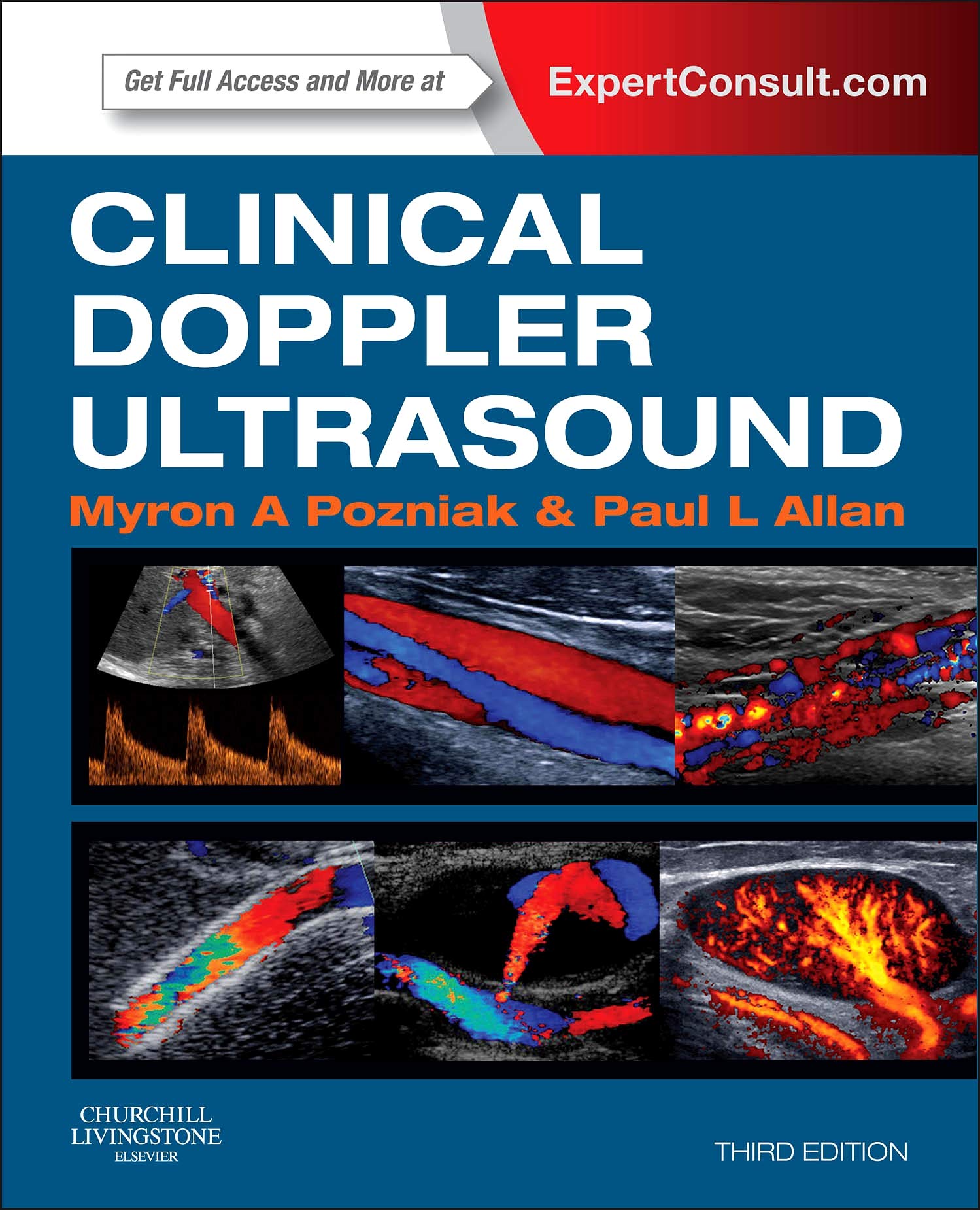 Clinical Doppler Ultrasound: Expert Consult: Online and Print Medicine