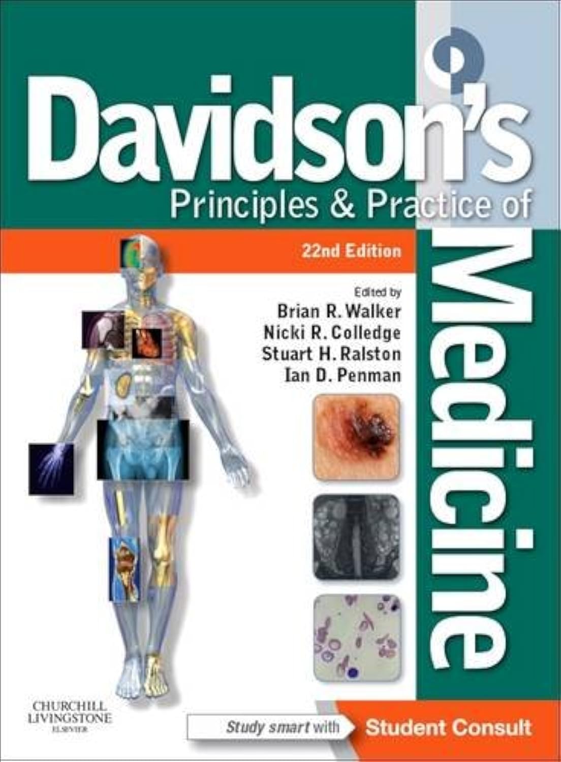 Davidson's Principles and Practice of Medicine: With STUDENT CONSULT Online Access Medicine