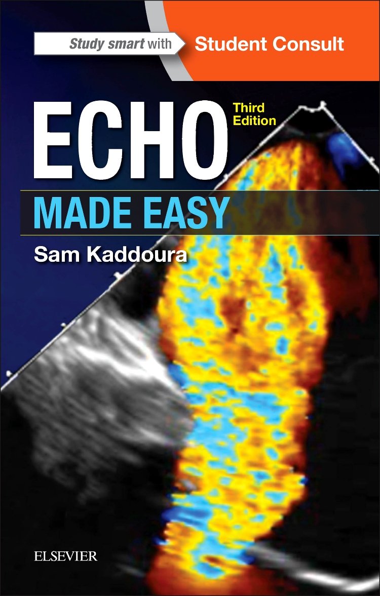 Echo Made Easy: Student Consult Medicine