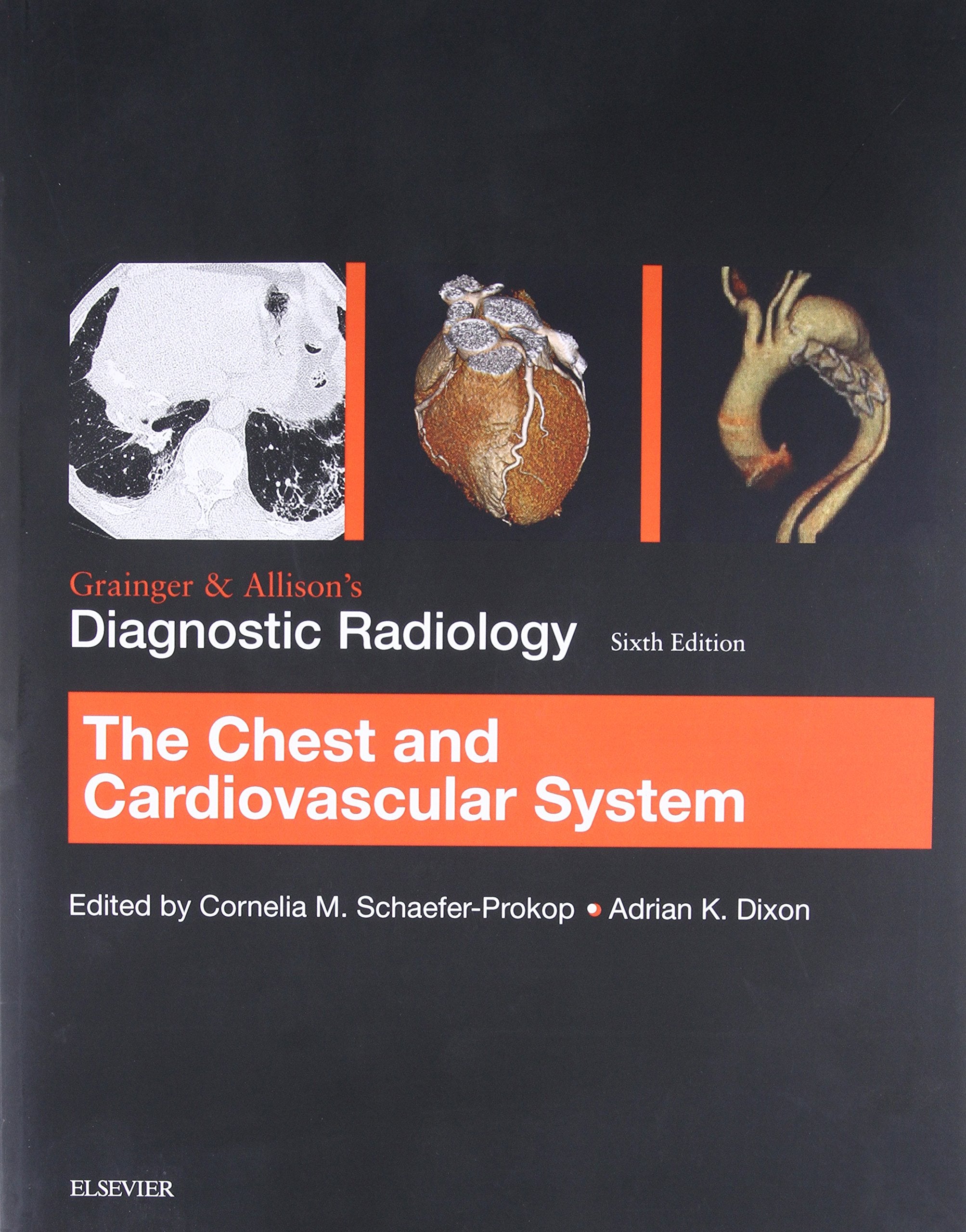 Grainger & Allison's Diagnostic Radiology: Chest and Cardiovascular System Medicine