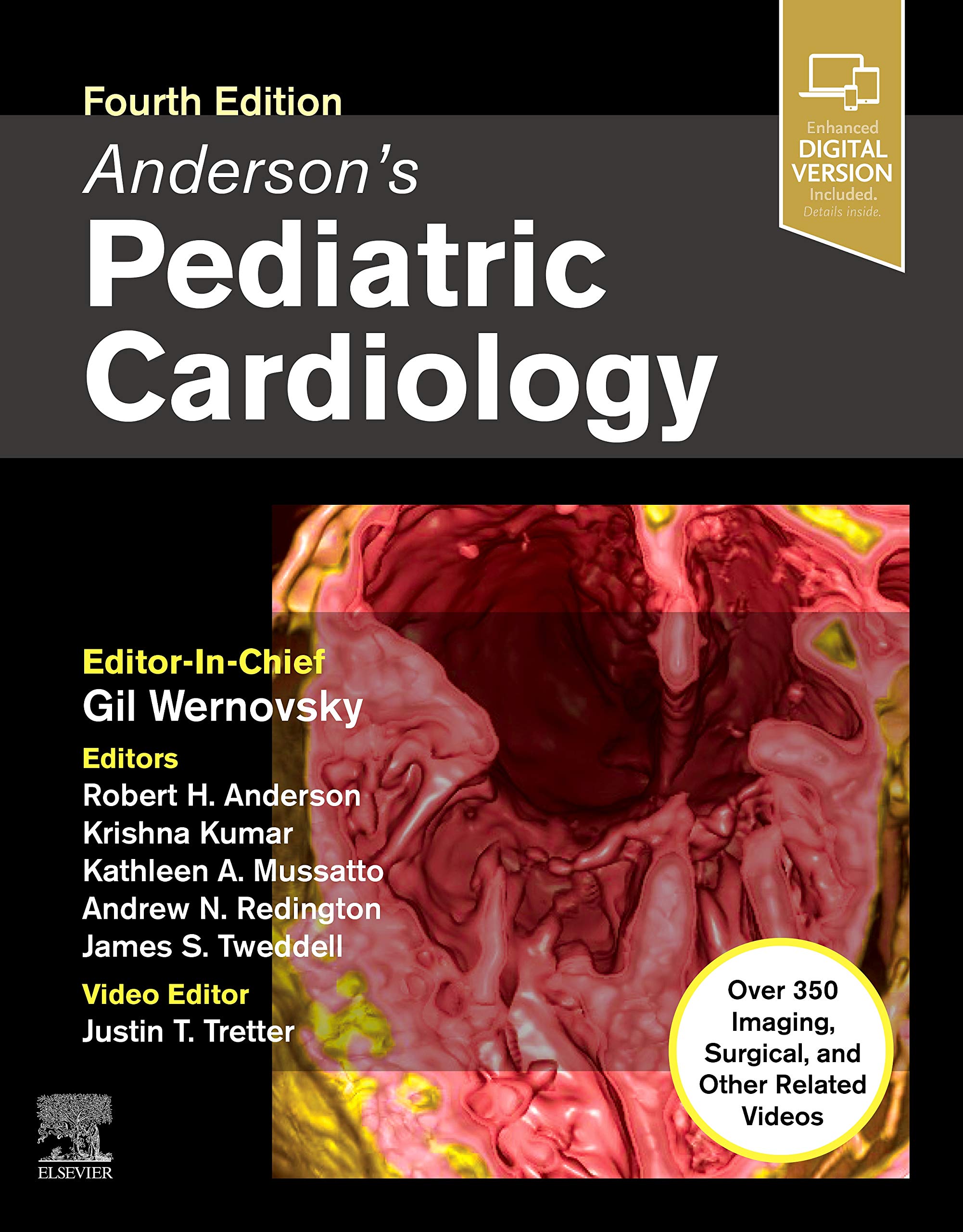 Anderson’s Pediatric Cardiology: Expert Consult - Online and Print Medicine