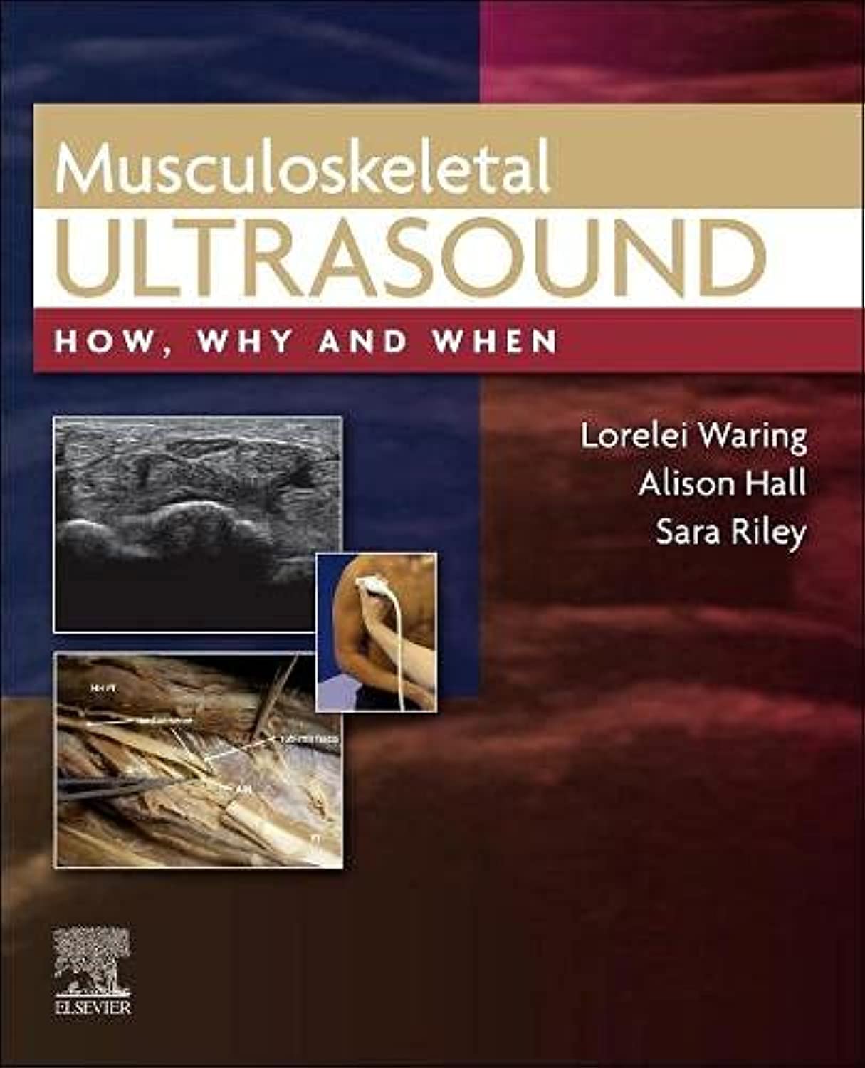 Musculoskeletal Ultrasound: How, Why and When Medicine