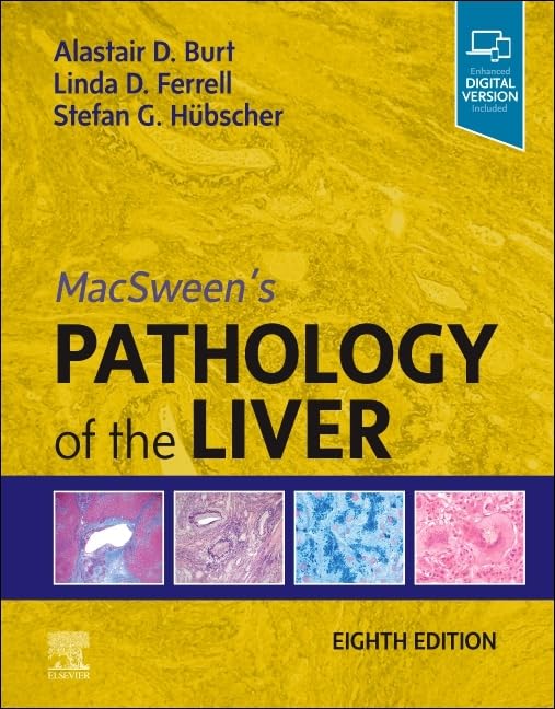 MacSween's Pathology of the Liver Medicine