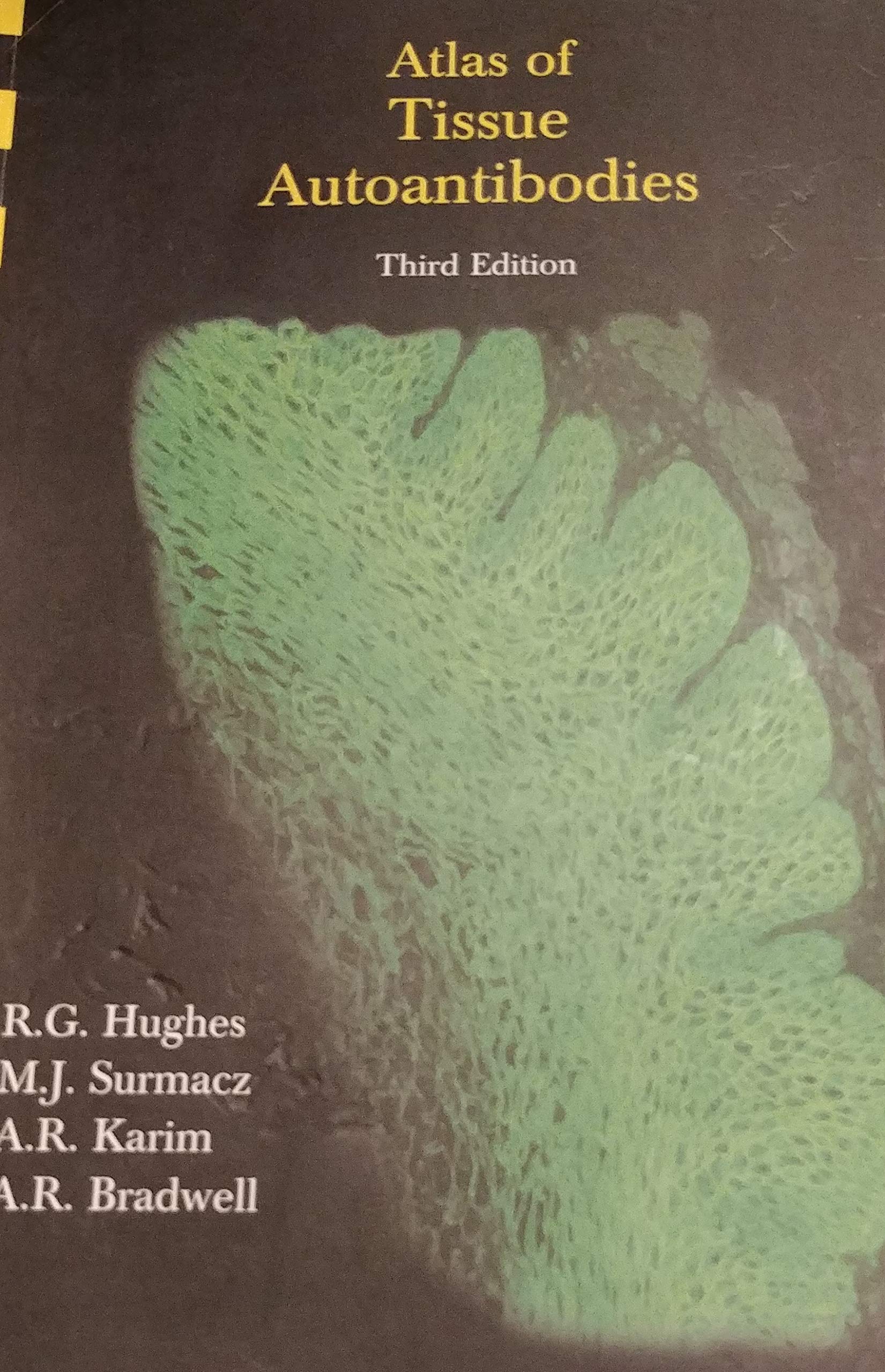 Atlas of Tissue Autoantibodies Medicine
