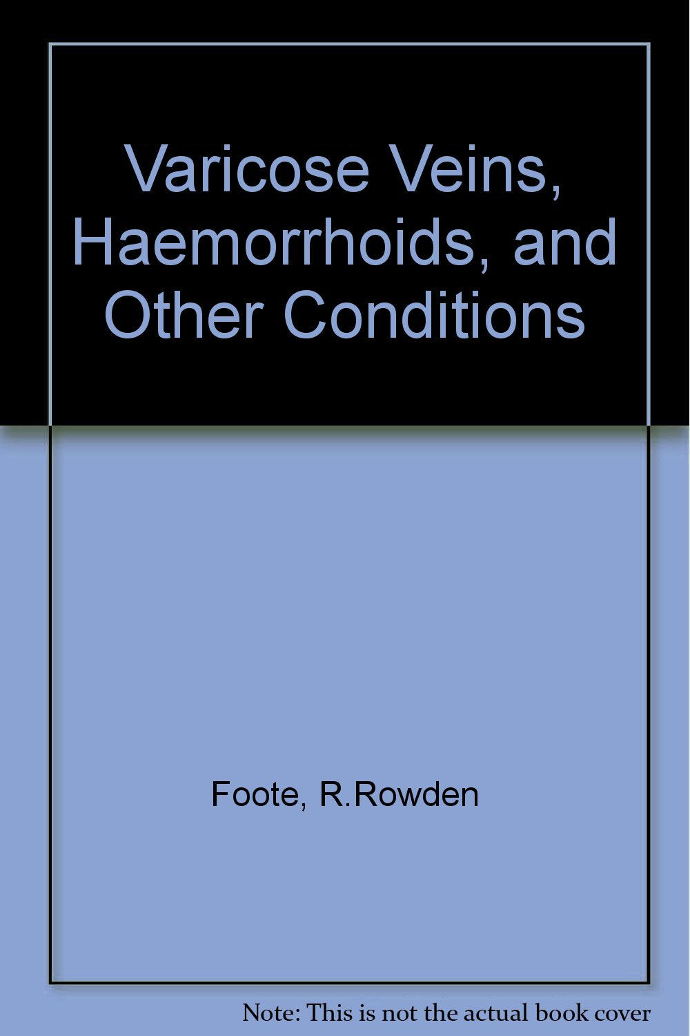 Varicose Veins, Haemorrhoids, and Other Conditions Books