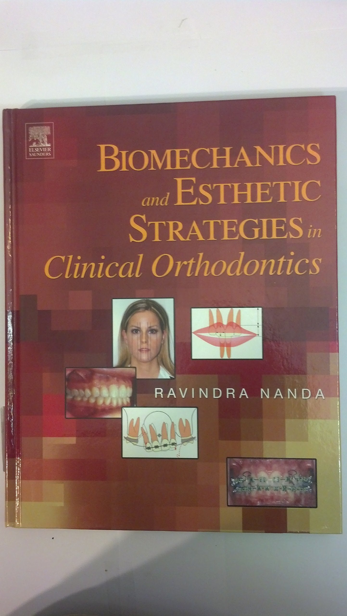 Biomechanics and Esthetic Strategies in Clinical Orthodontics Medicine