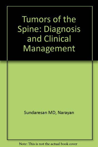 Tumors of the Spine: Diagnosis and Clinical Management Medicine