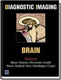 Diagnostic Imaging - Brain: Top 250 Diagnostic Medicine