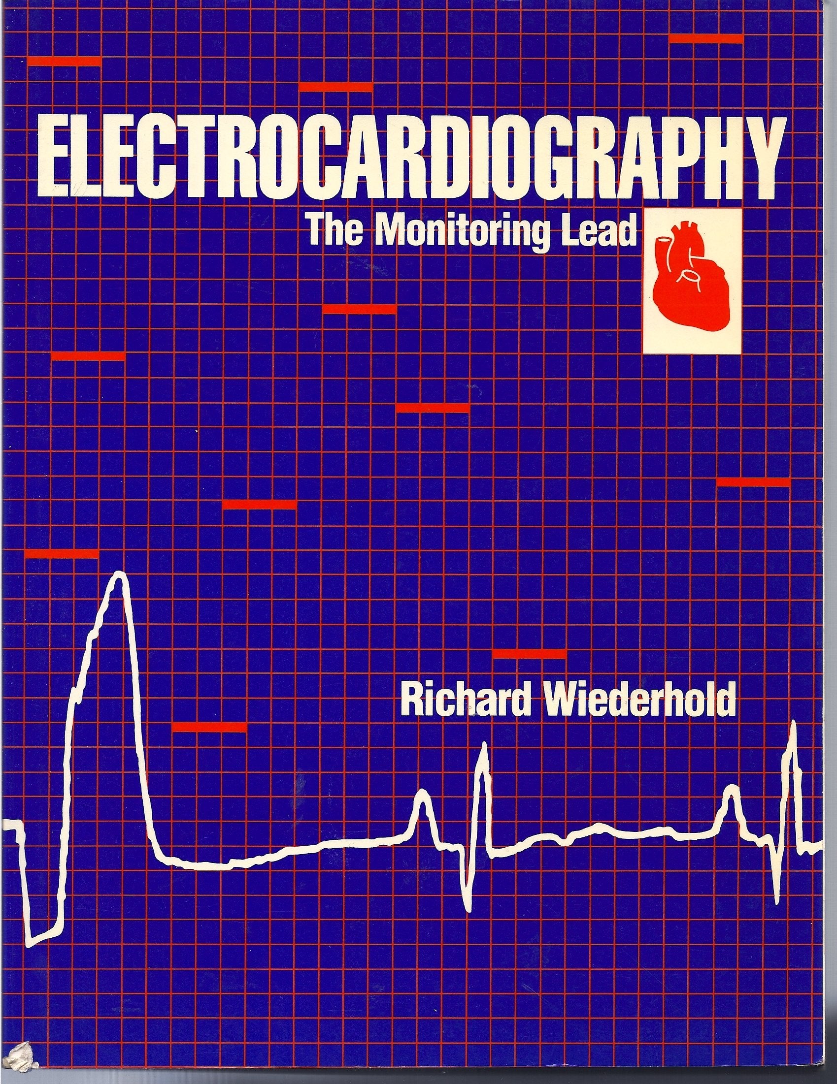 Electrocardiography: The Monitoring Lead: Monitor Lead Medicine