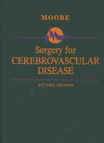 Surgery for Cerebrovascular Disease Medicine