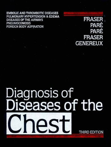 Diagnosis of Diseases of the Chest Medicine