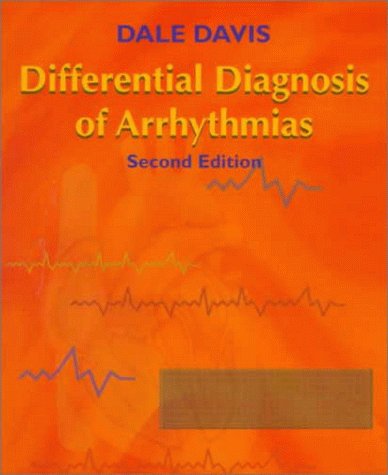 Differential Diagnosis of Arrhythmias Medicine